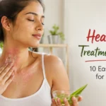 Heat Rash Treatment at Home